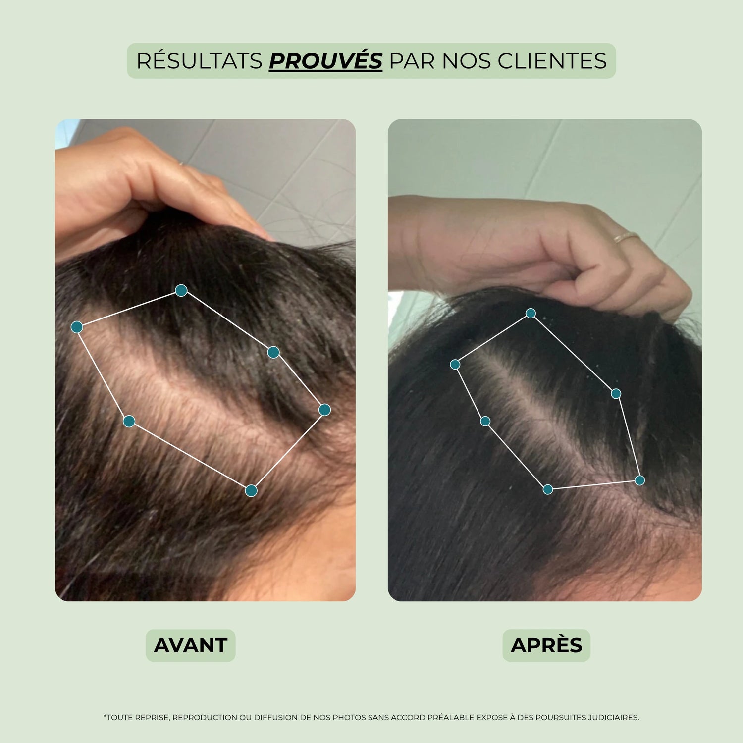 avant après spray chute cheveux