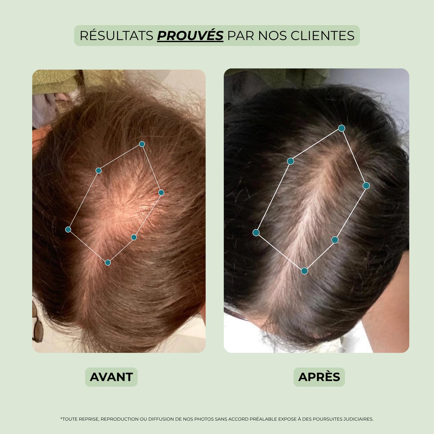avant après spray pousse cheveux