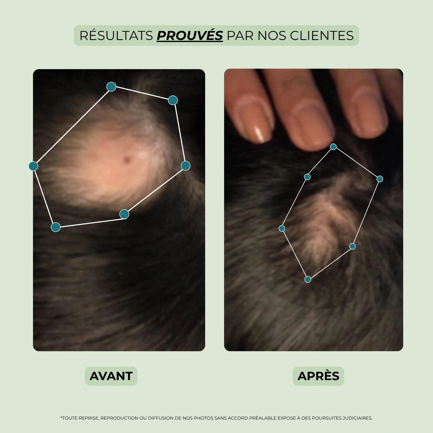 Résultats prouvés huile cheveux Biologist Mood – photo avant et après utilisation contre la chute.