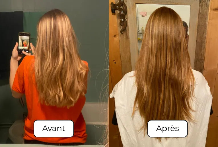 repousse cheveux chute stimulation pousse des cheveux densité capillaire