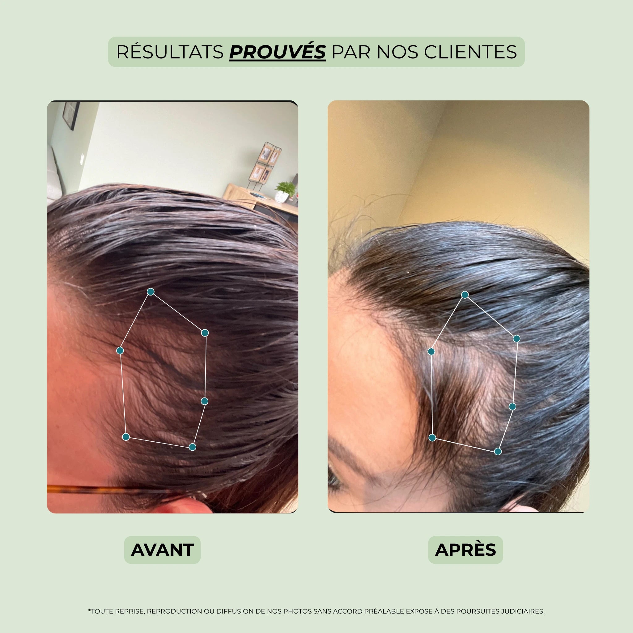 avant après huile essentielle pousse cheveux