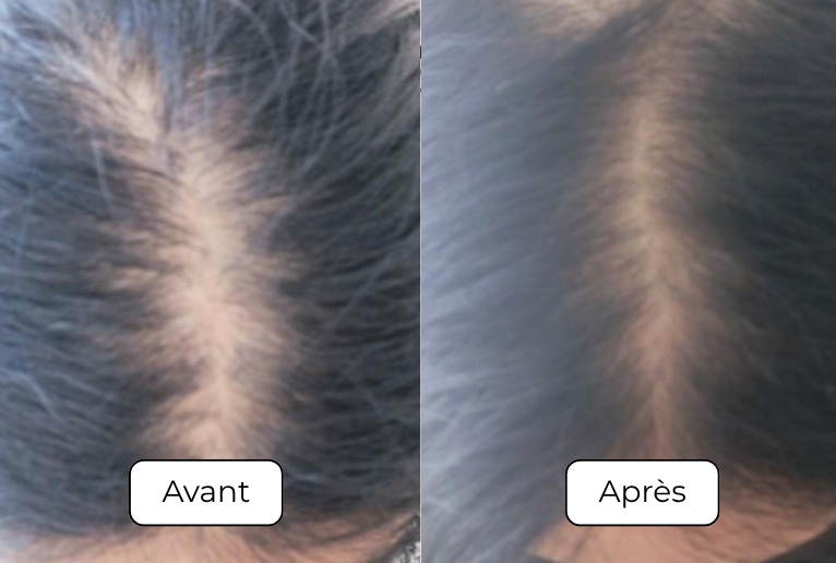 Yvana B., 52 ans