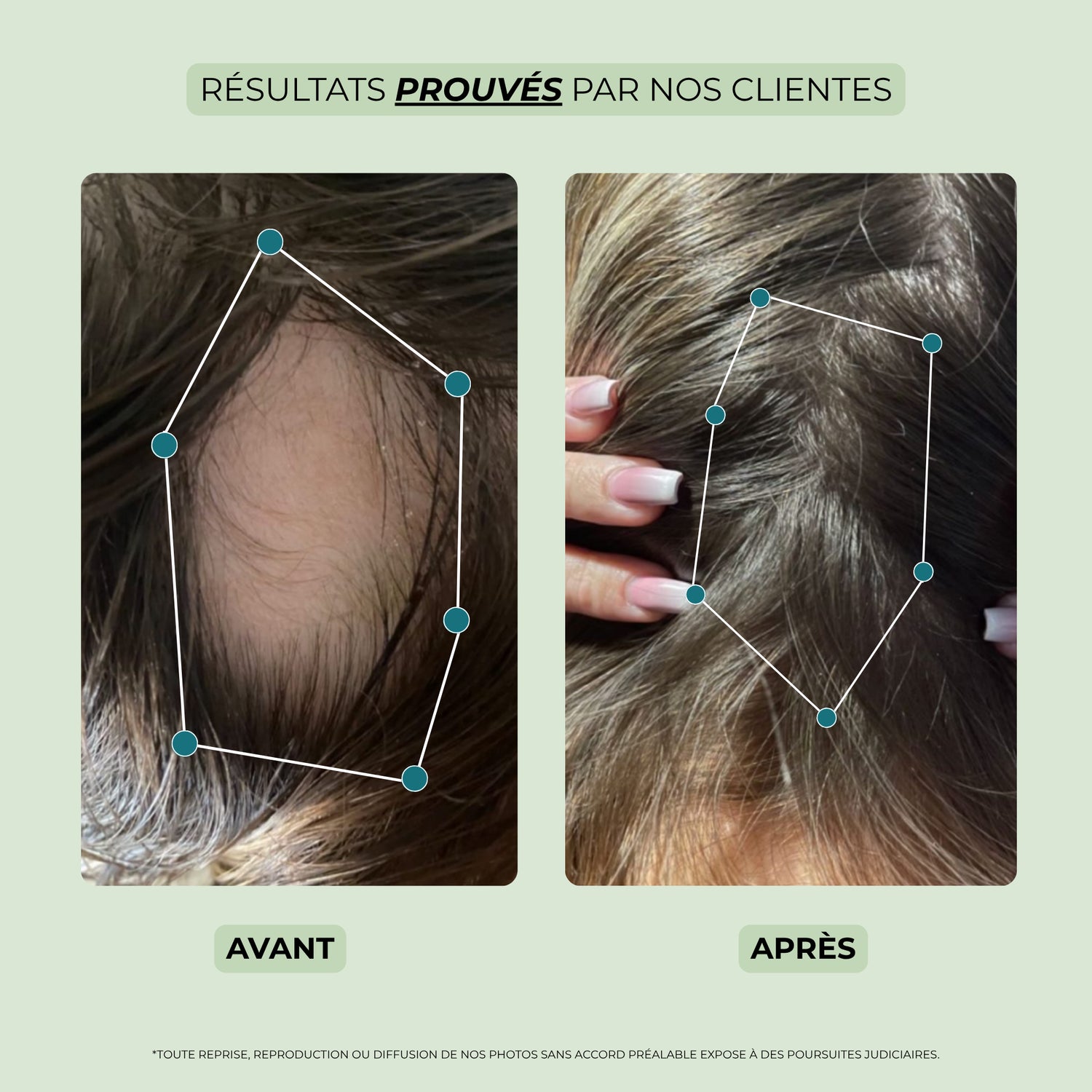 avant après huile pousse cheveux