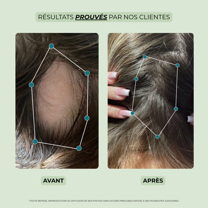 avant après huile pousse cheveux