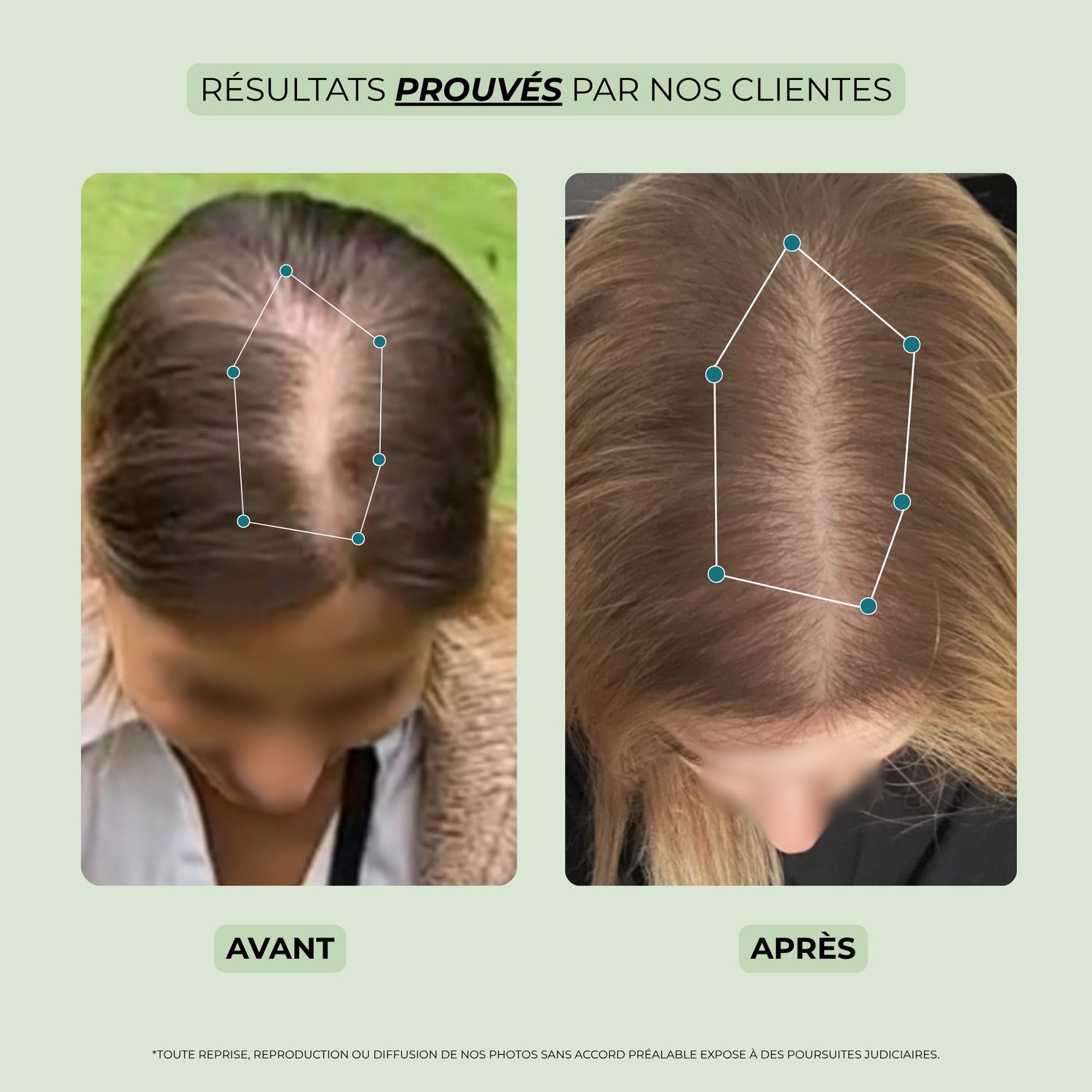 avant après huile pousse cheveux