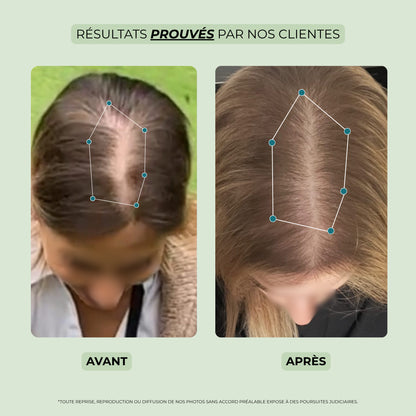 avant après huile pousse cheveux