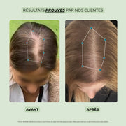 avant après huile pousse cheveux