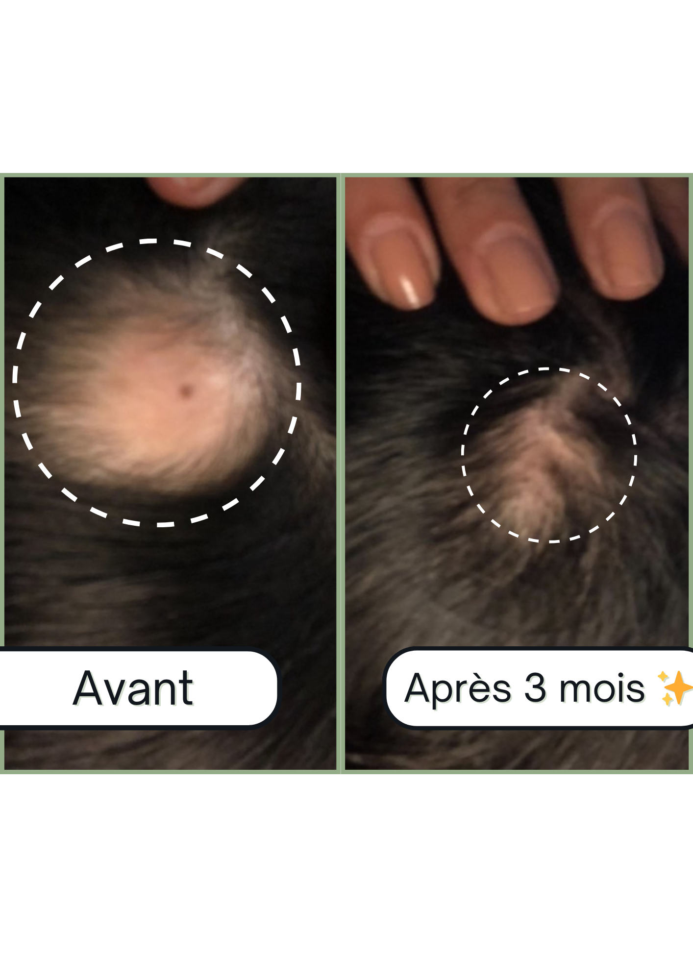 Accelerator Roll on Boost + : Roll-On pour la Pousse des Cheveux