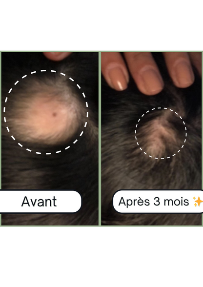 Accelerator Roll on Boost + : Roll-On pour la Pousse des Cheveux