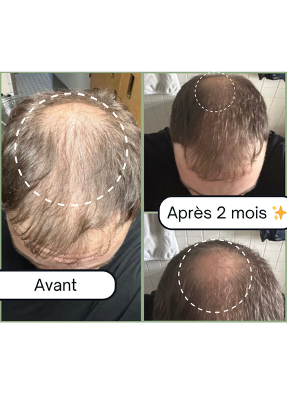 Avant après huile de pousse cheveux Biologist mood