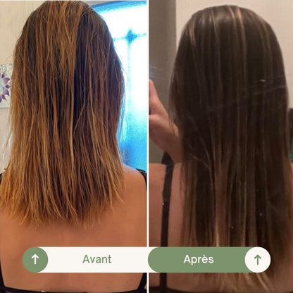 Accelerator Oil - Huile pousse cheveux naturelle &amp; anti-chute