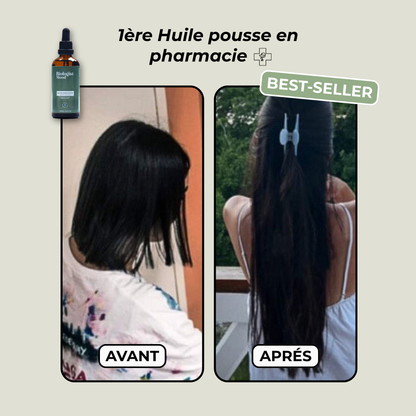 Accelerator oil - Huile pousse cheveux naturelle &amp; anti-chute