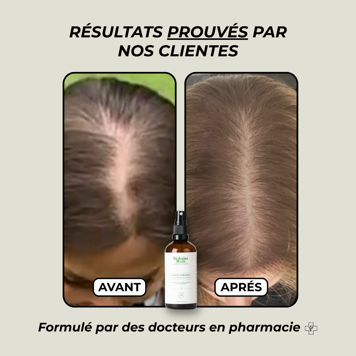 Rosemary lotion - Anti-hair loss spray with rosemary and cineole