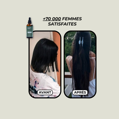 Duo Huile pousse - Accelerator oil + Dermastamp OFFERT !
