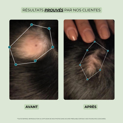  Résultats prouvés huile cheveux Biologist Mood – photo avant et après utilisation contre la chute.