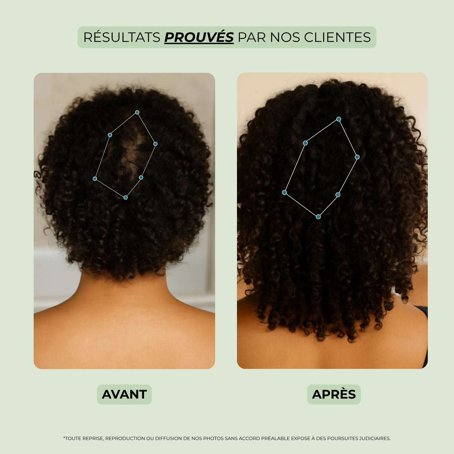Avant et après utilisation de l’huile pour pousse cheveux – repousse plus dense et cheveux renforcés
