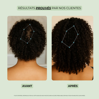 Avant et après utilisation de l’huile pour pousse cheveux – repousse plus dense et cheveux renforcés