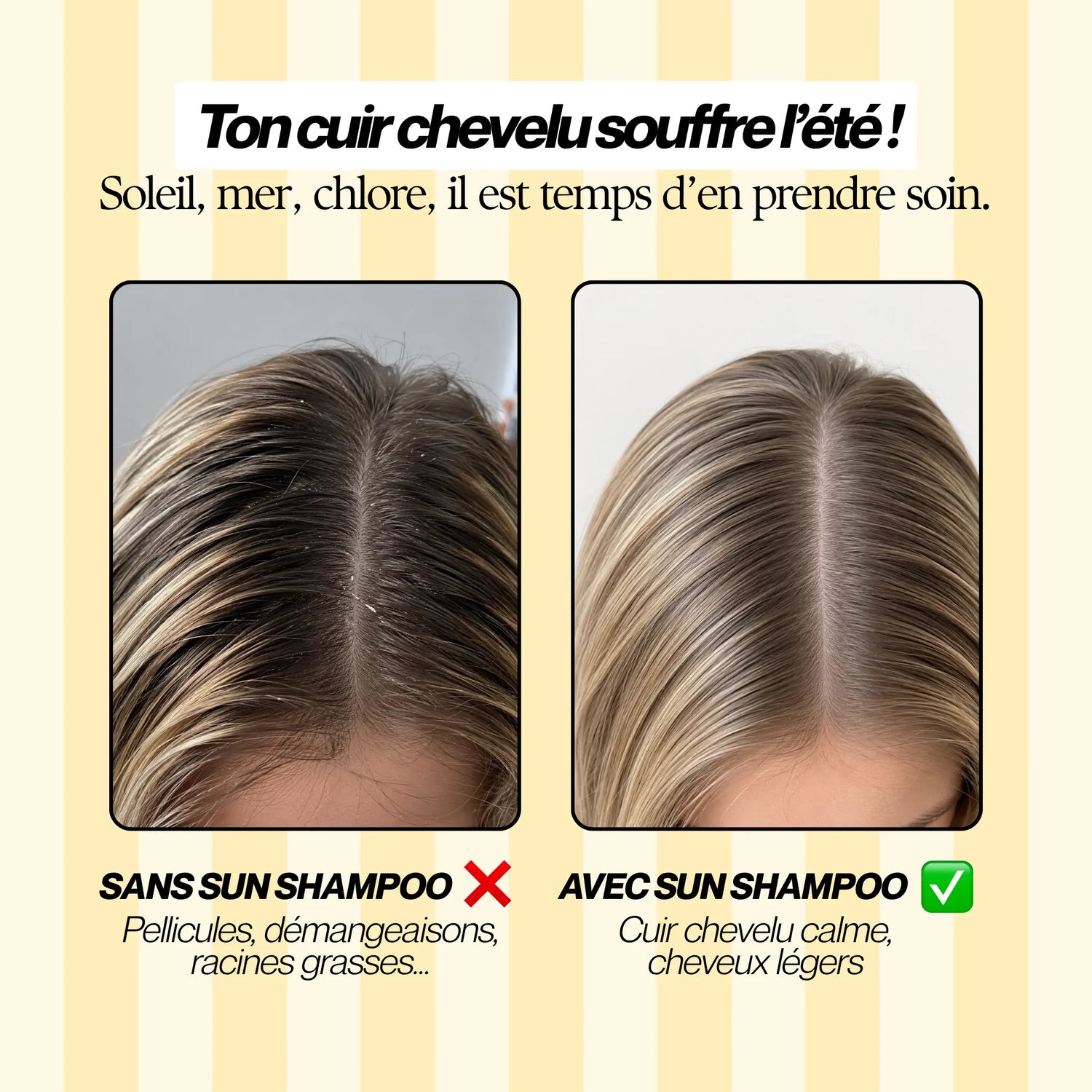 Comparatif avant après utilisation du shampoing solaire sans sulfate Biologist Mood : cuir chevelu apaisé, moins de pellicules, moins de démangeaisons et cheveux légers.