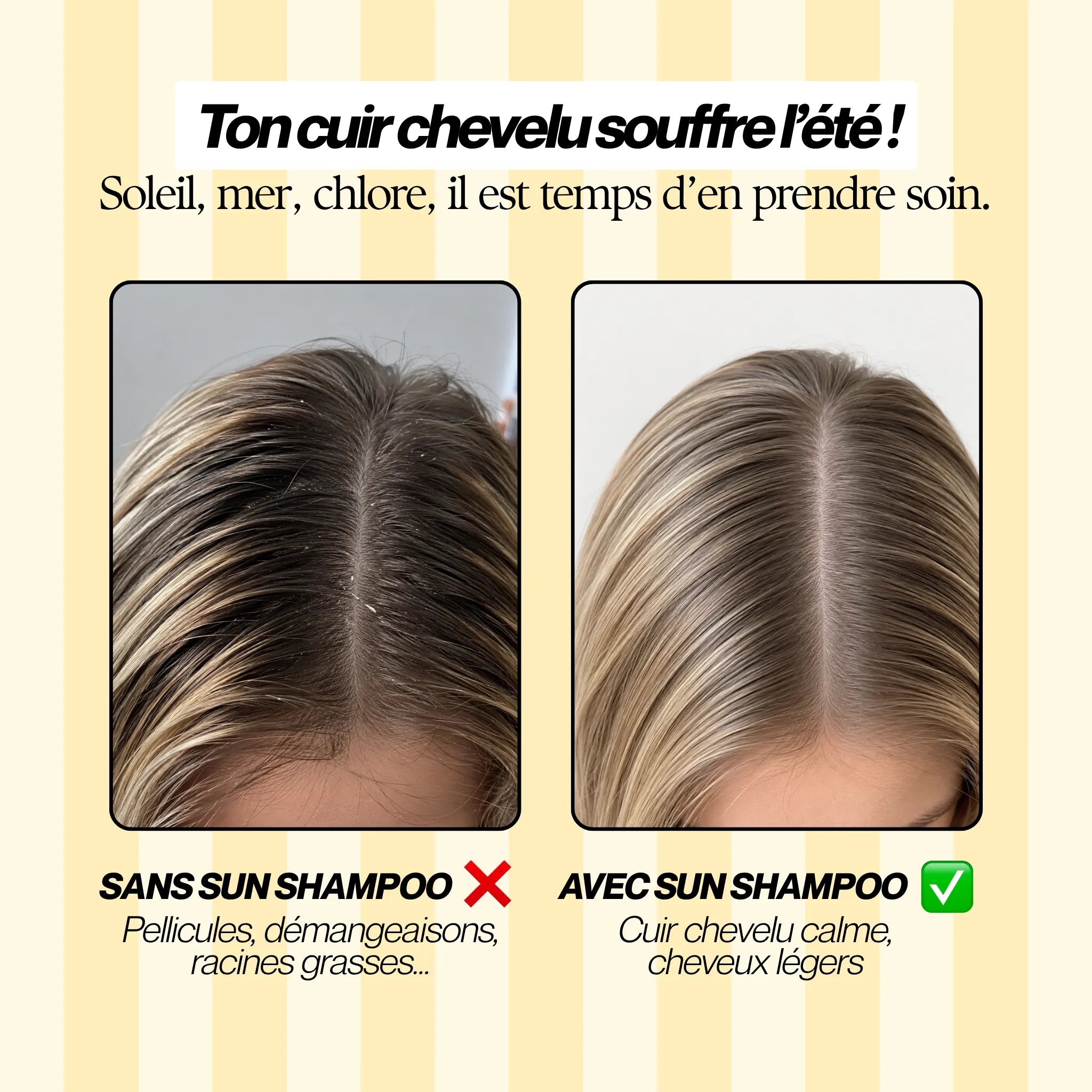 Comparatif avant après utilisation du shampoing solaire sans sulfate Biologist Mood : cuir chevelu apaisé, moins de pellicules, moins de démangeaisons et cheveux légers.