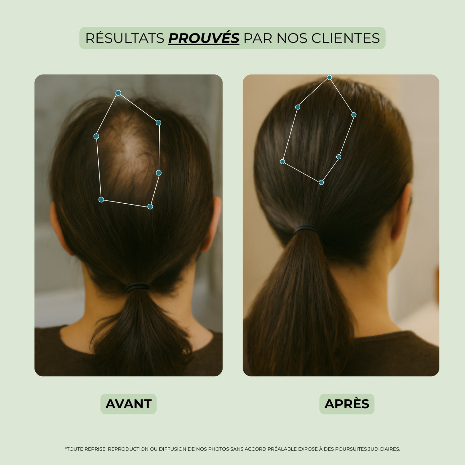 Résultats du sérum pousse cheveux sur cheveux crépus – densité et brillance améliorées