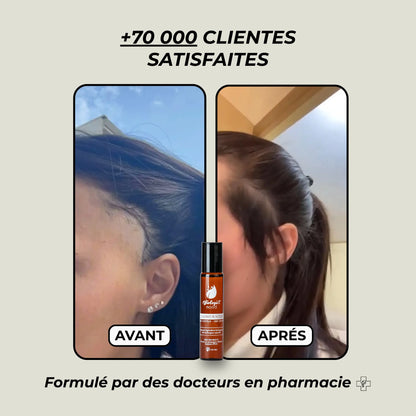 Avant et après l&